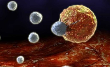 The attack of a tumour cell made by white blood cells of the patient (lymphocytes) generated by cancer vaccines. The attack of a tumour cell made by white blood cells of the patient (lymphocytes) generated by cancer vaccines.